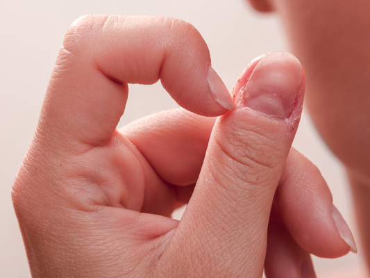 Stop Nail Biting!